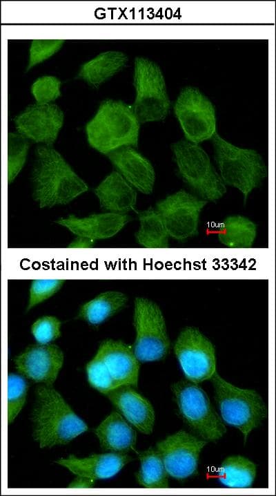 IHC-plus™ TPP1 / CLN2 Antibody (aa66-324)