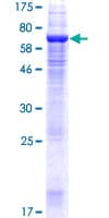 Human TMEM49 Protein (Recombinant GST)