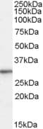 IHC-plus™ RPL8 / Ribosomal Protein L8 Antibody (aa181-195)