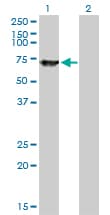 Monoclonal Mouse anti-Human SWAP70 Antibody (clone 3H8, IHC, WB)