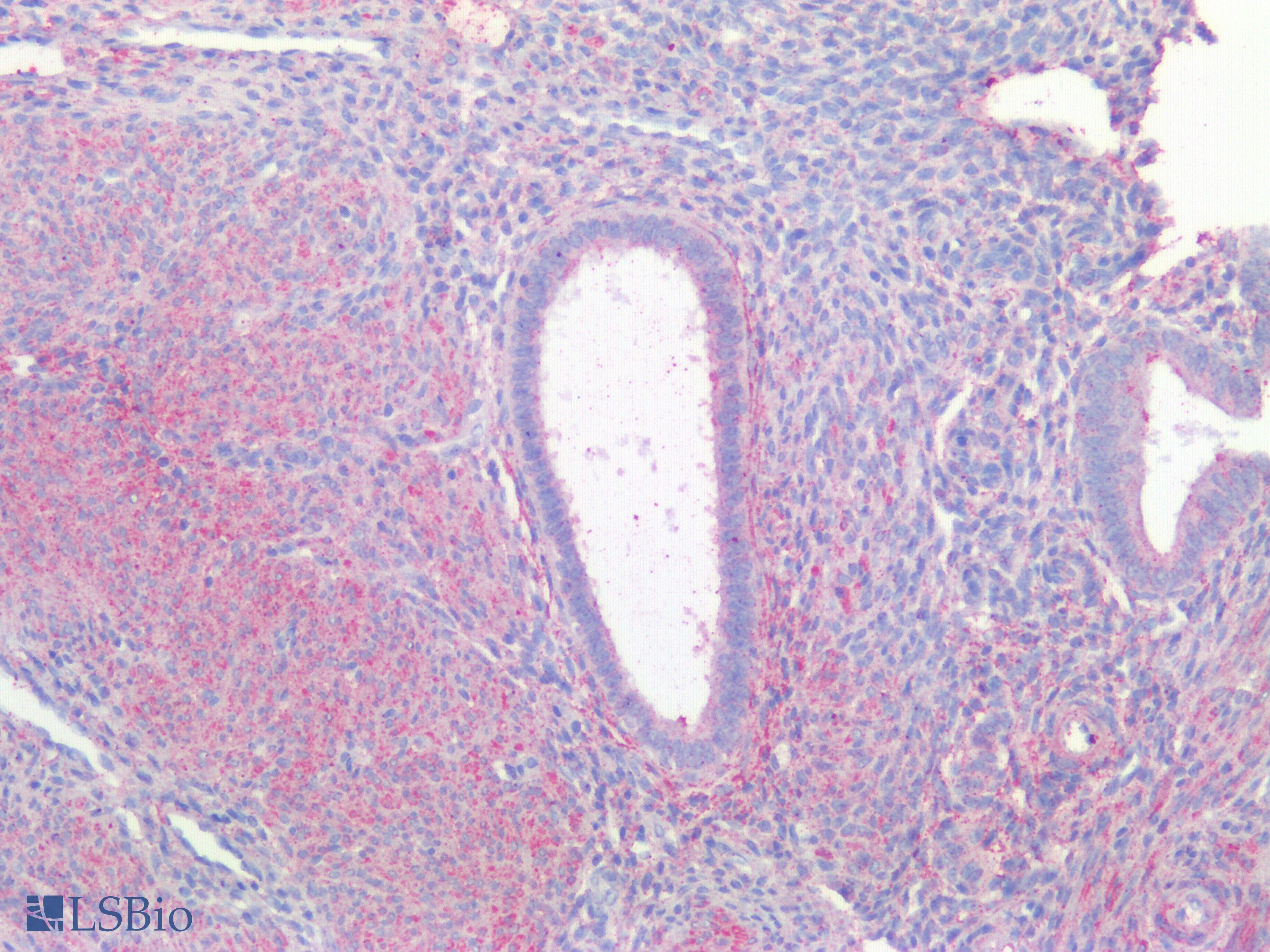 PathPlus™ Polyclonal Rabbit anti-Human HAVCR1 / KIM-1 Antibody (IHC)