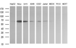ZSCAN21 / Zipro1 Antibody (clone OTI2H8)