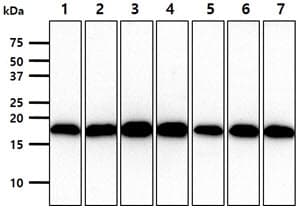VHL / Von Hippel Lindau Antibody (clone AT82B10)