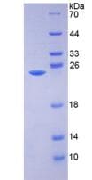 Mouse AMBP Protein (Recombinant His)
