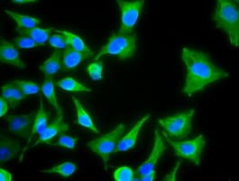KRT8 / CK8 / Cytokeratin 8 Antibody (clone OTI1B12)