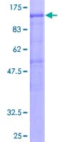 Human DDX20 / GEMIN3 Protein (Recombinant GST)