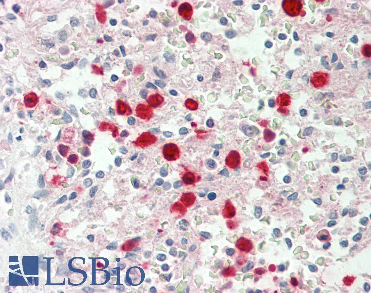 IHC-plus™ CDA / Cytidine Deaminase Antibody