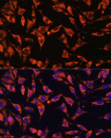 JAG2 / Jagged-2 Antibody