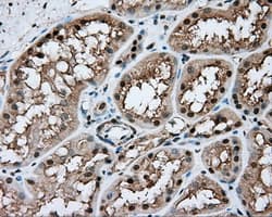NIT1 Antibody (clone OTI3A11)
