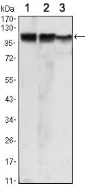 IHC-plus™ HK2 / Hexokinase 2 Antibody (clone 3D3)