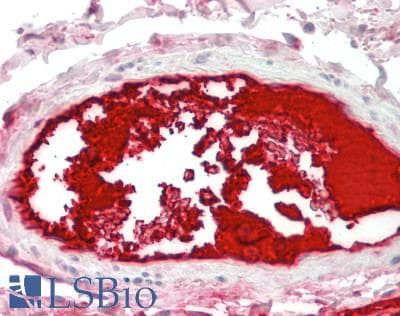 IHC-plus™ SERPING1 / C1 Inhibitor Antibody