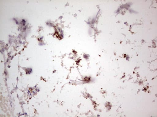 Monoclonal Mouse anti-Human NEFM / NF-M Antibody (clone OTI2G3, aa413-773, IHC, WB)