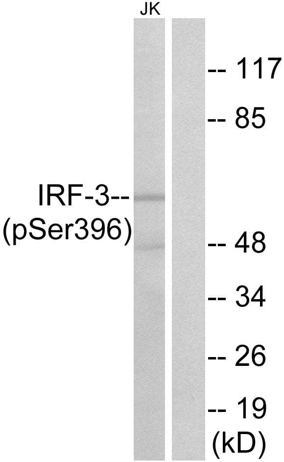 IRF3 Antibody (phospho-Ser396)