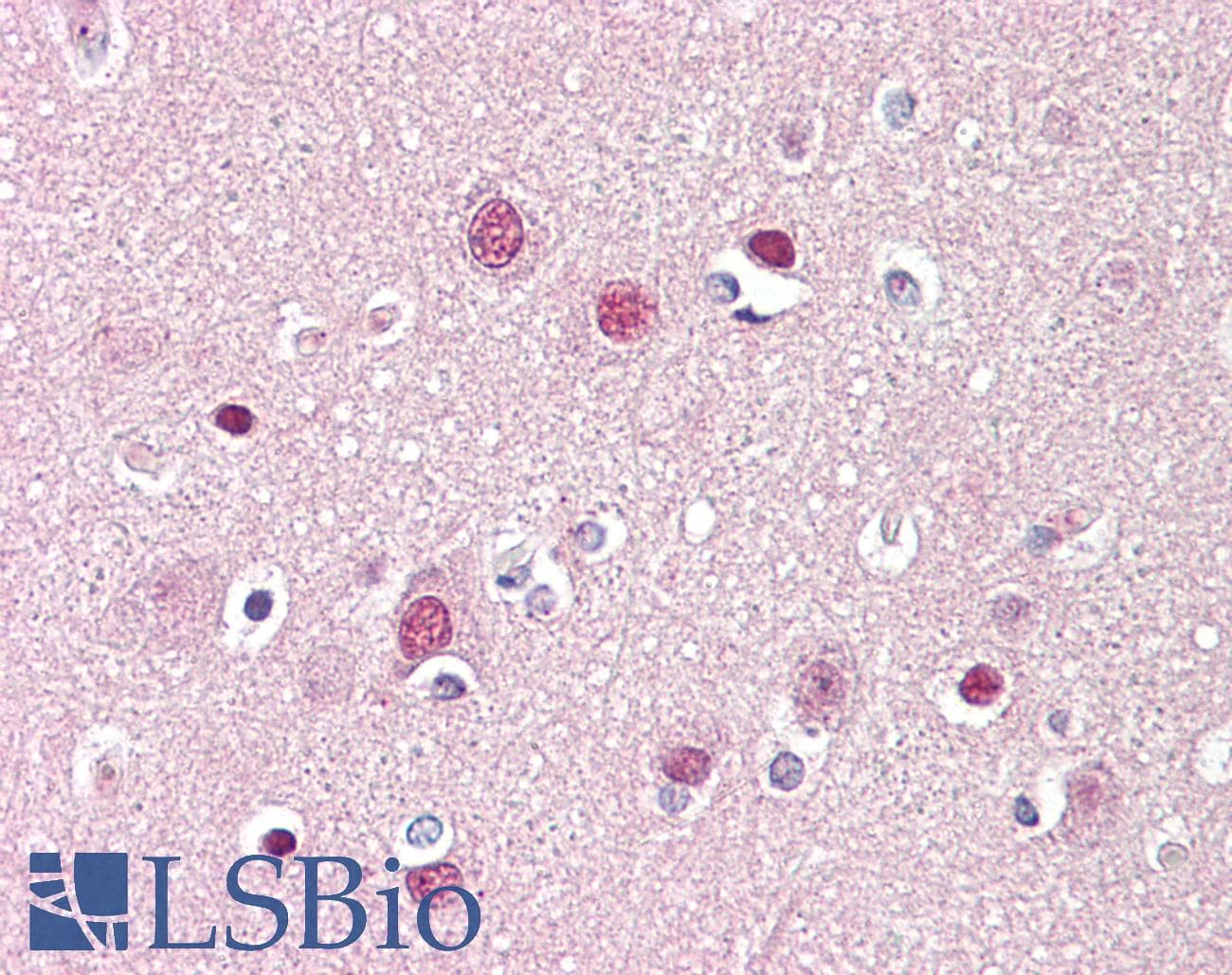 IHC-plus™ ADD1 / Adducin Alpha Antibody (aa411-460)