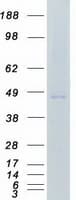 Human CSNK1E / CK1 Epsilon Protein (Recombinant Myc-DDK (Flag))
