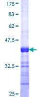 Human PAFAH1B1 / LIS1 Protein (Recombinant GST, N-terminus)