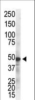 IKBKG / NEMO / IKK Gamma Antibody (clone 55AT986.5.78)