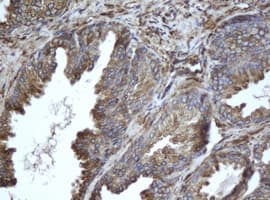 EPHX1 / Epoxide Hydrolase 1 Antibody (clone OTI3F10)