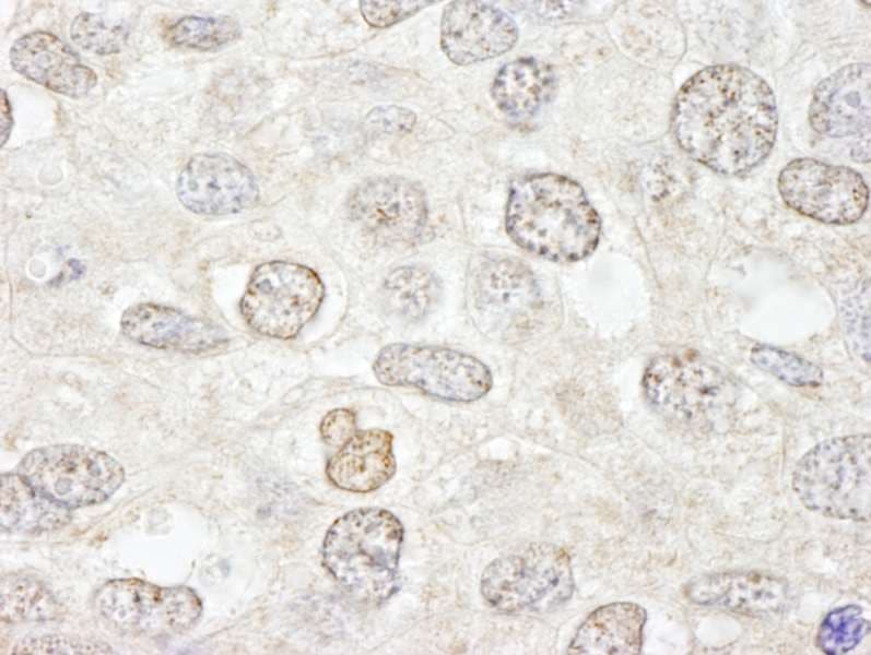 NUP50 Antibody (aa418-468)