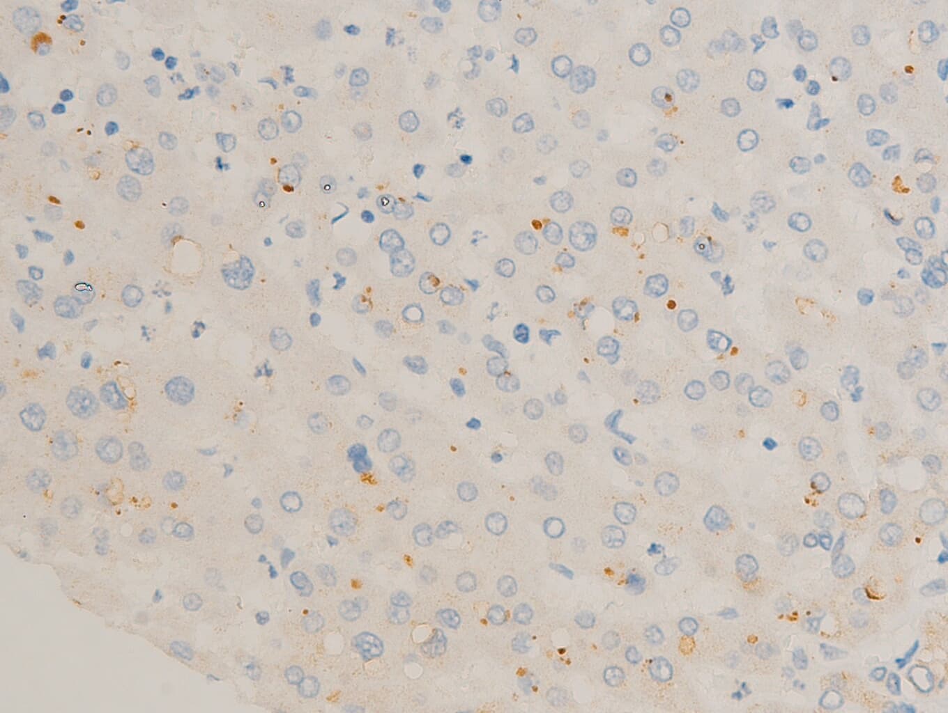 Polyclonal Rabbit anti-Human FOS / c-FOS Antibody (phospho-Ser362, IHC, IF, WB)