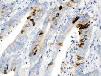 ITLN1 / Omentin Antibody