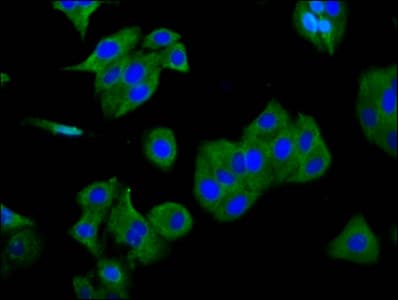 Polyclonal Rabbit anti-Human SGCG / Gamma-Sarcoglycan Antibody (IHC, IF)