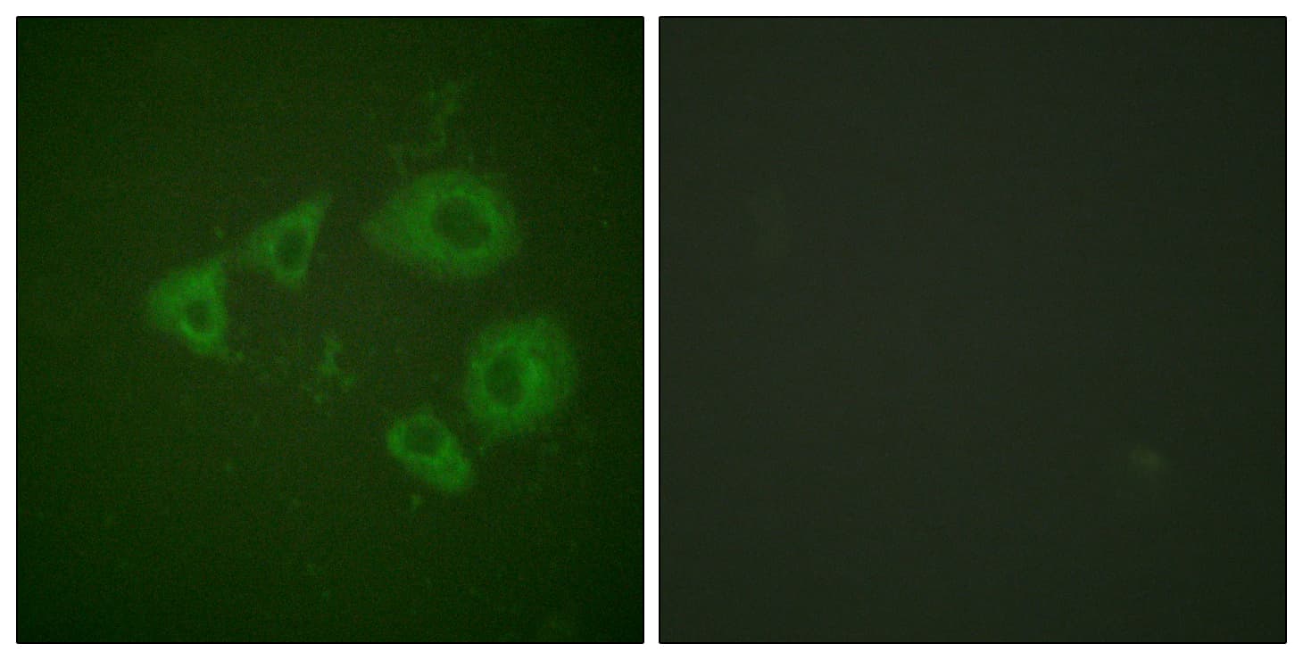 NTRK2 / TRKB Antibody (phospho-Tyr705)