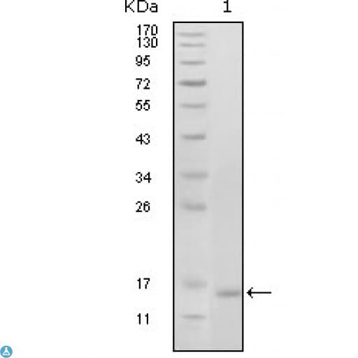 EPHB6 / EPH Receptor B6 Antibody