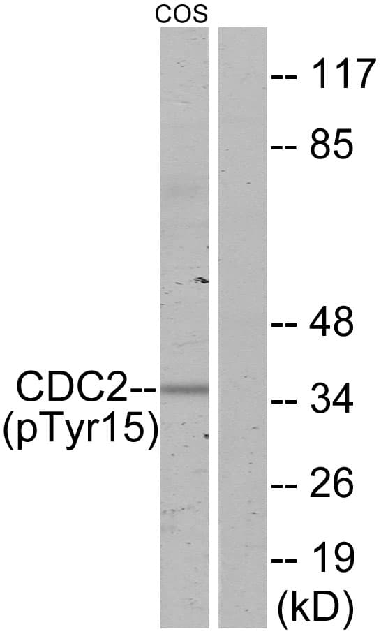 Polyclonal Rabbit anti-Human CDK1 / CDC2 Antibody (phospho-Tyr15, WB)