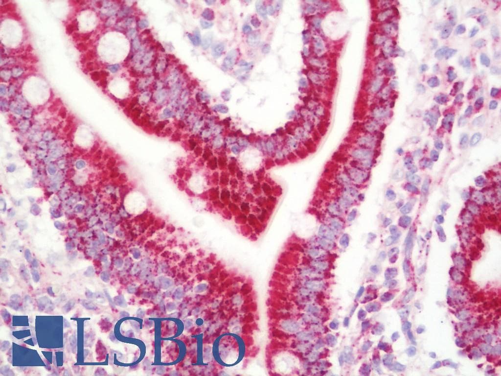 IHC-plus™ UQCRC1 Antibody (clone 1G6)