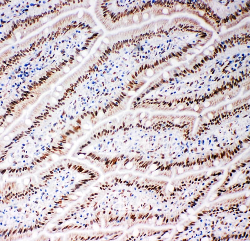LMNB2 / Lamin B2 Antibody (aa580-597)