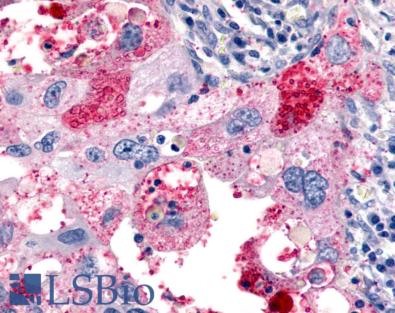 PathPlus™ ADGRL4 / ELTD1 Antibody (N-Terminus)