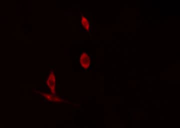 TNFSF10 / TRAIL Antibody