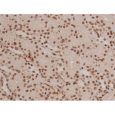 FAK / Focal Adhesion Kinase Antibody (phospho-Tyr397)