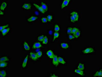 SLC6A3 / Dopamine Transporter Antibody