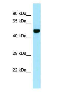 CILP Antibody (aa955-1004)
