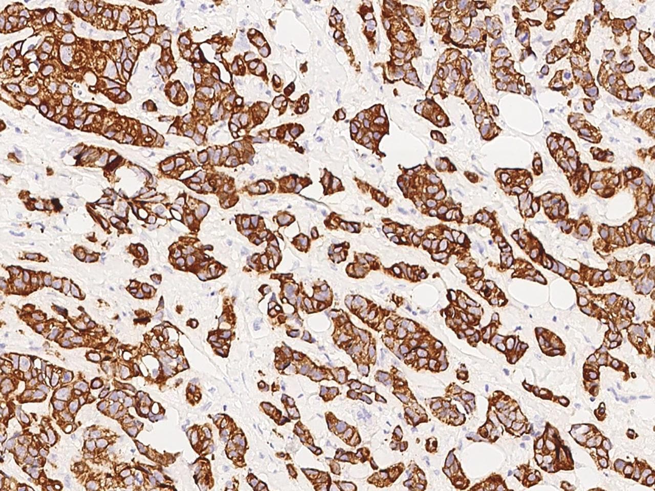 KRT76 / Keratin 76 Antibody (Preservative Free)