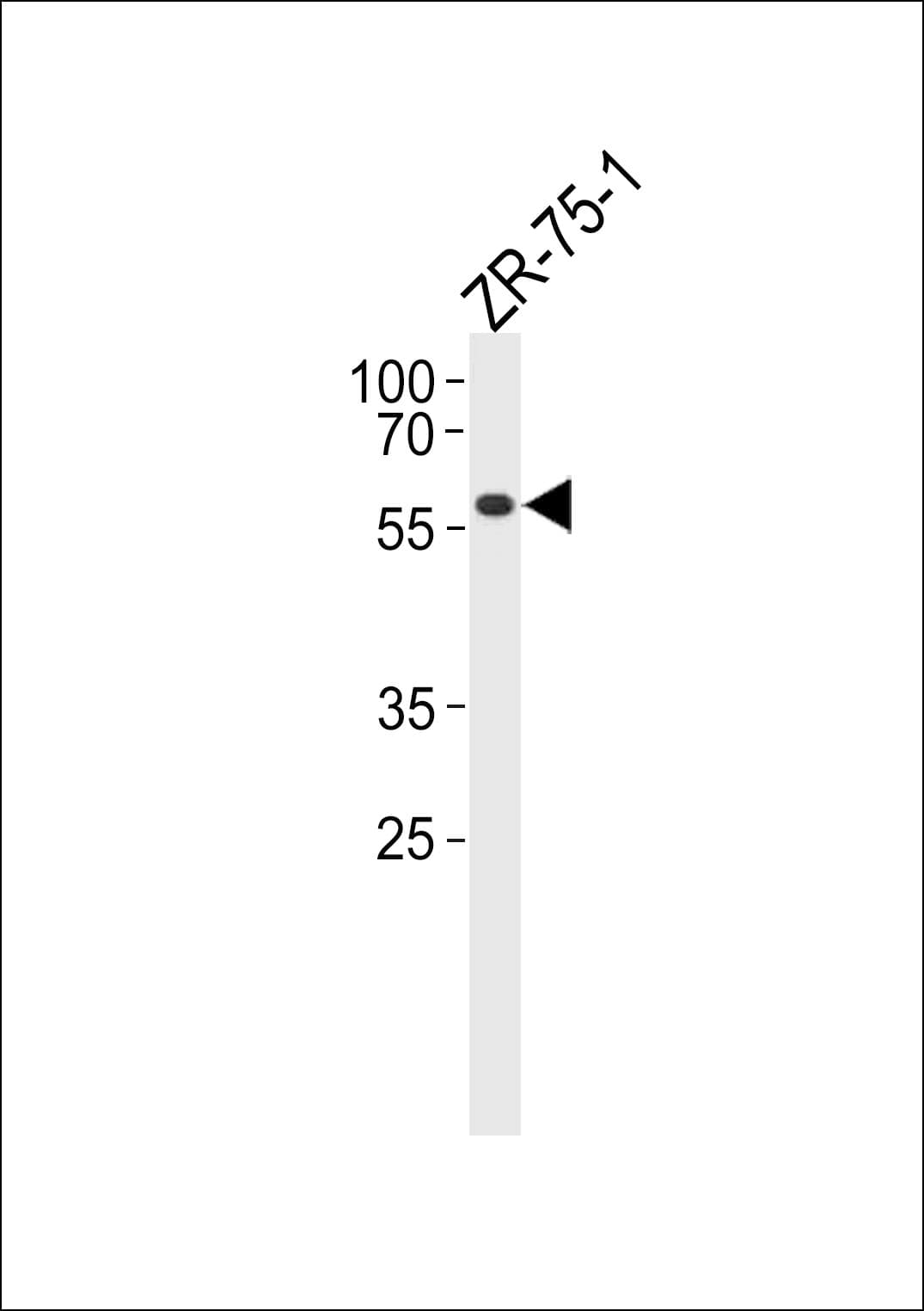 PPP2R2A Antibody (aa43-71)