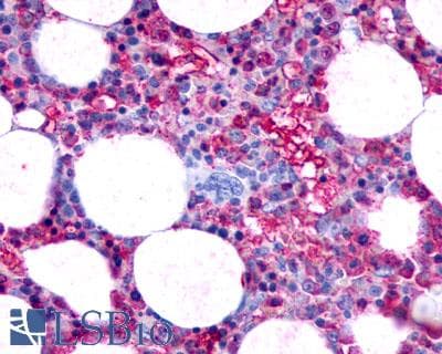 PathPlus™ Polyclonal Rabbit anti-Human F2RL3 / PAR4 Antibody (Extracellular Domain, IHC)