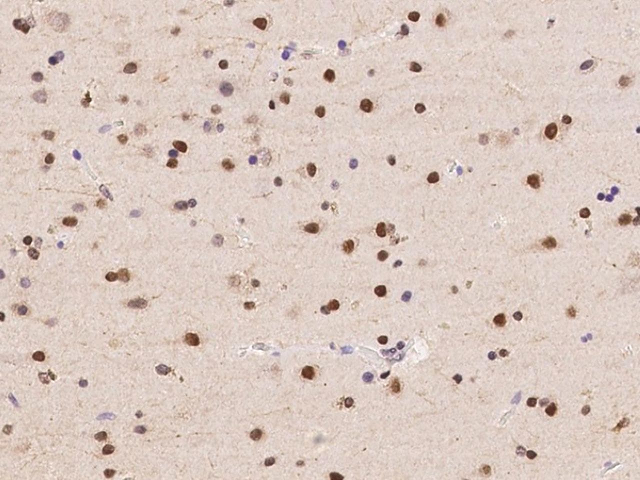 Polyclonal Rabbit anti-Human METTL21B / FAM119B Antibody (IHC, IF)