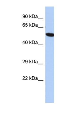 Polyclonal Rabbit anti-Human ZNF559 Antibody (aa123-172, WB)
