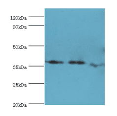IHC-plus™ ALK2 / ACVR1 Antibody (aa20-125)