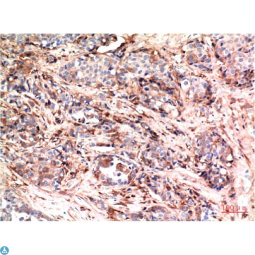 AKT1 Antibody