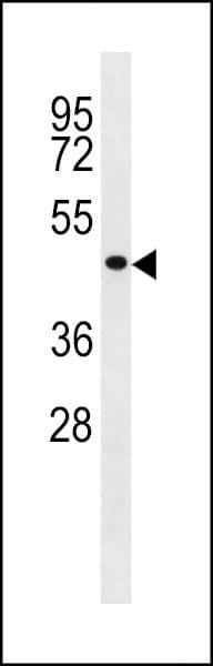TP53 / p53 Antibody (aa314-342)