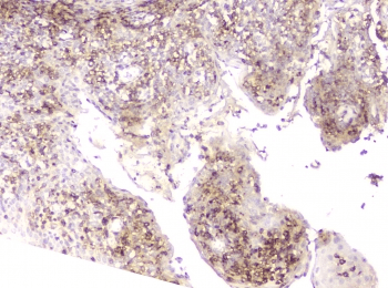 LCP1 / L-Plastin Antibody