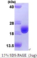 Human TXN / Thioredoxin / TRX Protein (Recombinant His)