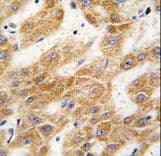 P5CDH / ALDH4A1 Antibody (aa533-561)