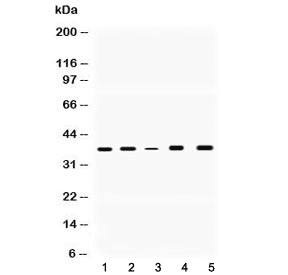 GAPDH Antibody