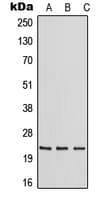 Polyclonal Rabbit anti-Human RAB30 Antibody (Internal, WB)
