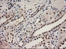 LOX / Lysyl Oxidase Antibody (clone OTI10D11)